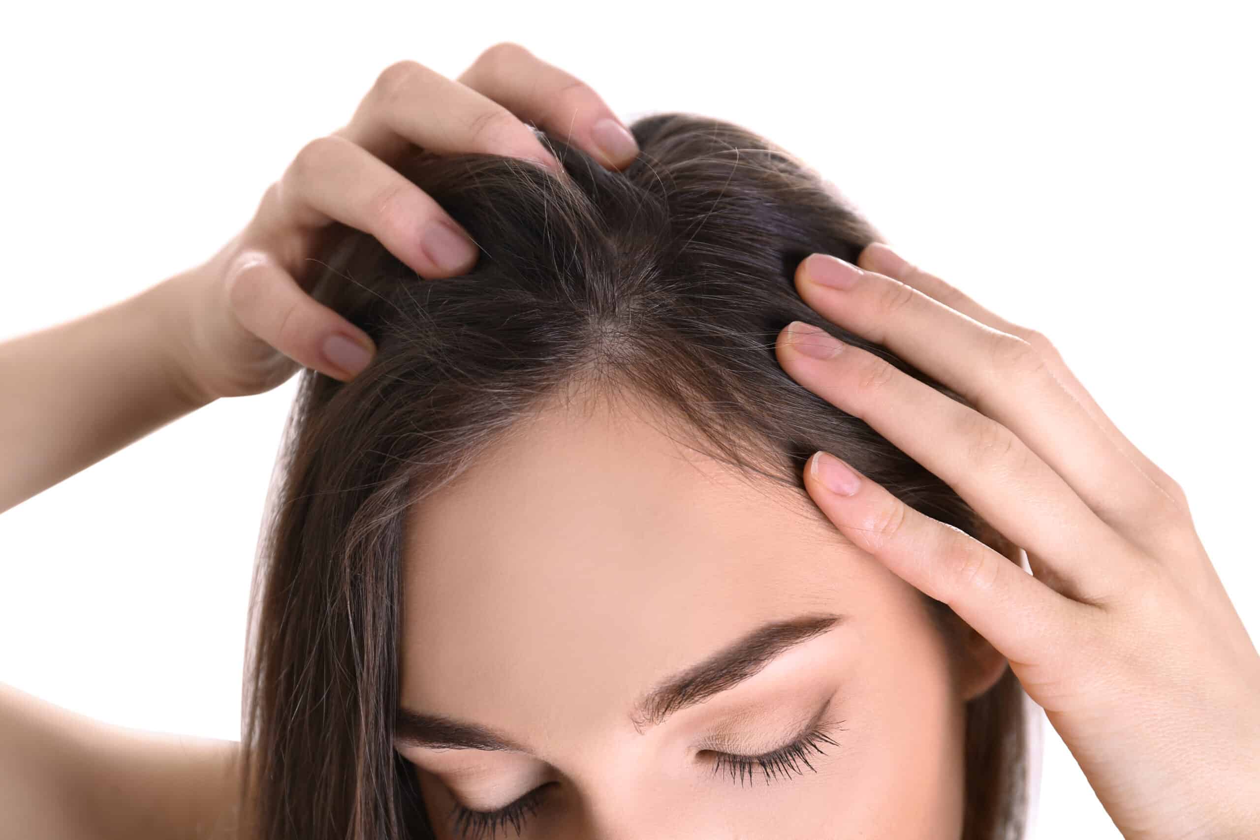 All You Need to Know About Scalp Acne and How to Treat It - Ensoul Medical  Clinic