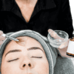 hormonal-acne-treatments-and-remedies